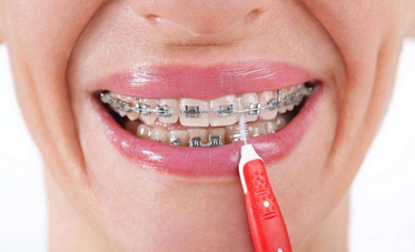 做牙齿矫正会出现哪些危害