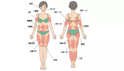 吸脂手术六大问