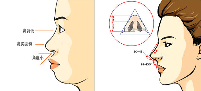 隆鼻真的会使脸变小？