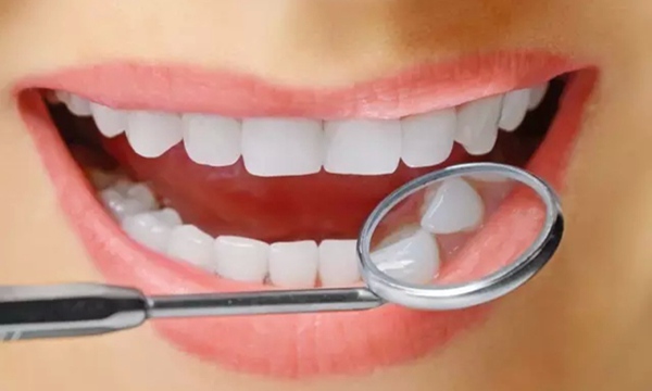 牙齿矫正改善外貌和健康