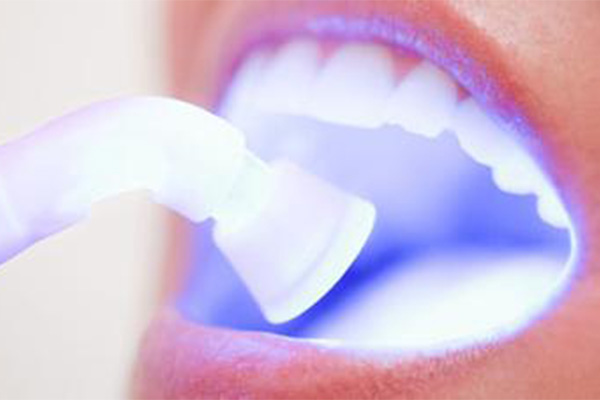 牙齿美白有什么副作用