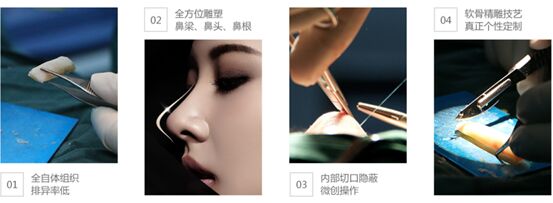 恭祝上海美莱SAP多维鼻修复技术新品发布