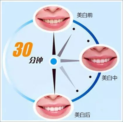 上海美莱帮您解决牙齿节后综合症