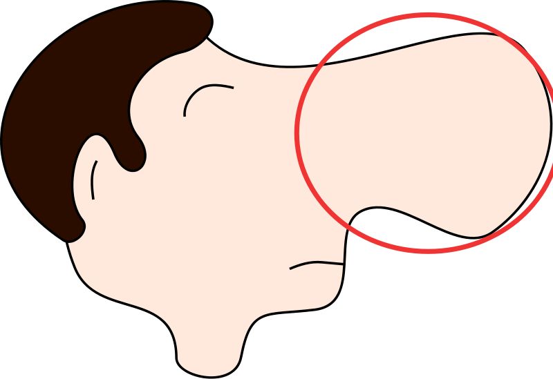 鼻尖整形美容手术方法是什么