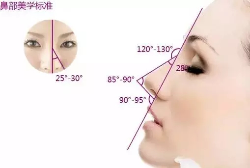 假体隆鼻优势是什么