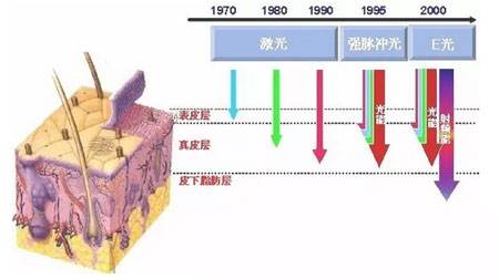 激光红血丝