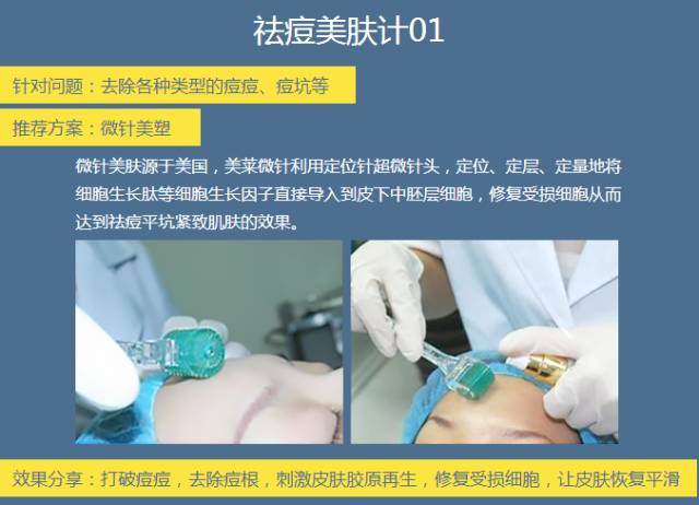 上海美莱祛痘过程