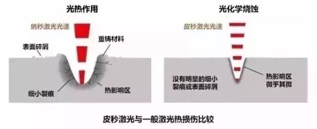 上海美莱皮秒祛斑降低皮肤损伤