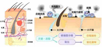 上海除腋臭手术