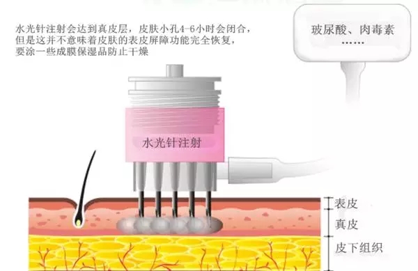 注射水光多久打快速