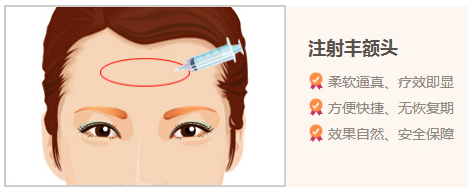 美莱玻尿酸丰额头效果