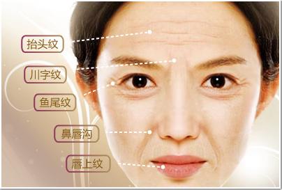 40岁以后:因为皮肤深层结构的位移和面部容积的减少,面部皱纹严重