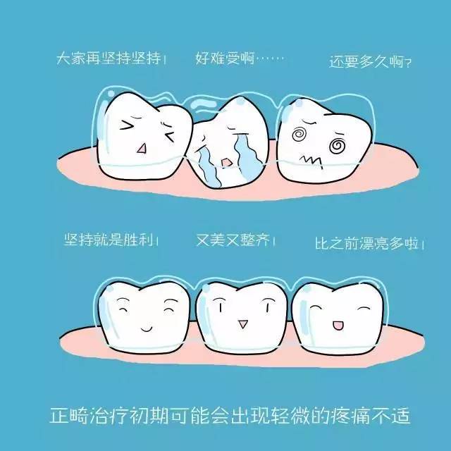 牙齿矫正方法