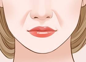 玻尿酸填充鼻唇沟可维持多久