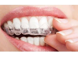 牙齿矫正效果理想离不开术后护理