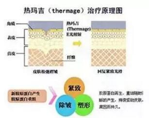 上海美莱医院除皱效果怎么样