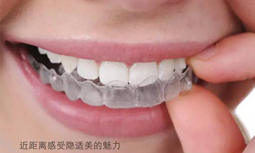 上海美莱牙齿矫正