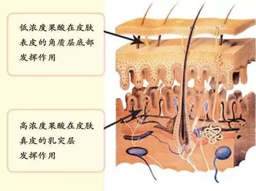 上海美莱化学酸换肤，重拾婴儿肌