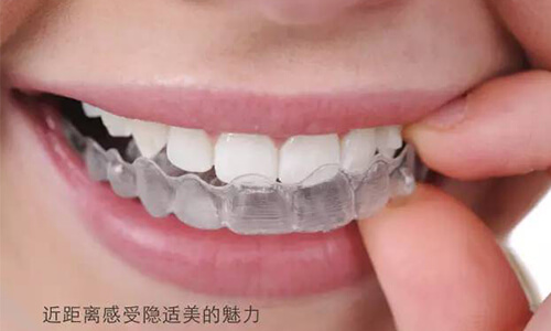 上海做牙齿矫正的价格多少