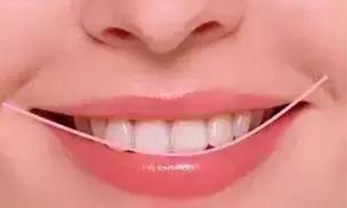牙齿矫正方式有几种，哪种好