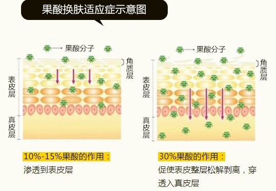 脸上很多痘痘怎么办，化学酸可以祛痘吗