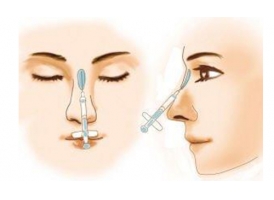 注射隆鼻有不易有副作用，怎么避免