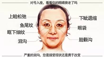 上海美莱医院去除泪沟的3大方法