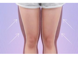 大腿吸脂减肥后的护理方法