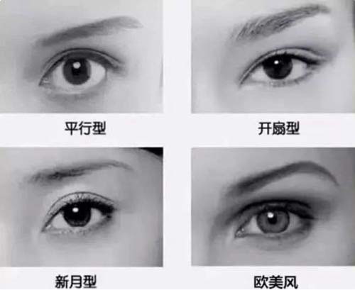 双眼皮的类型有几种，适合什么人群