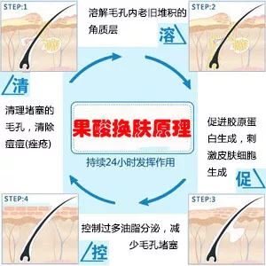 上海美莱化学酸换肤祛痘效果好吗
