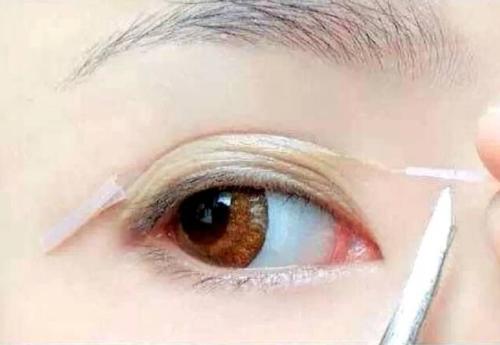 化妆术和双眼皮手术哪个效果更好