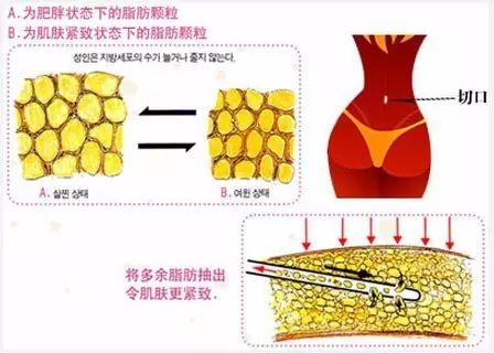 减肥瘦身什么方法比较好