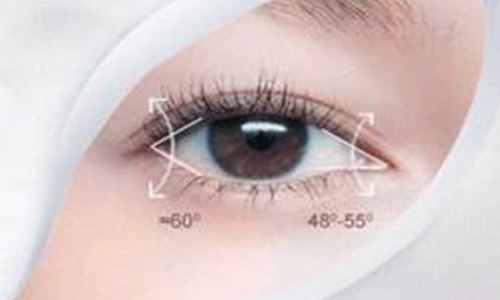 双眼皮有哪几种类型，哪种效果好