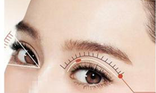 上海双眼皮修复手术需要多少钱