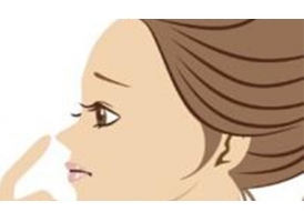 隆鼻整形材料有三种，选择哪种隆鼻效果比较好