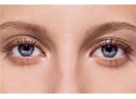双眼皮埋线整形手术能保持多长时间呢