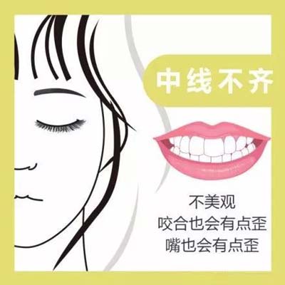 上海做隐形牙齿矫正医院哪家好