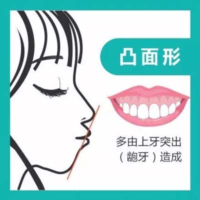 上海做隐形牙齿矫正医院哪家好