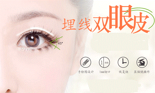 上海割双眼皮价格一般是多少呢