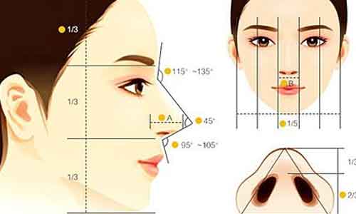 假体隆鼻会移动吗，上海隆鼻效果可以维持很久吗