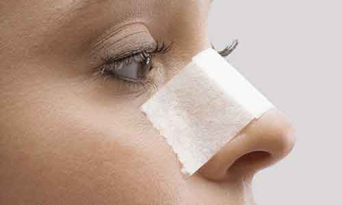 埋线隆鼻原理是什么，上海埋线隆鼻效果可以维持多久