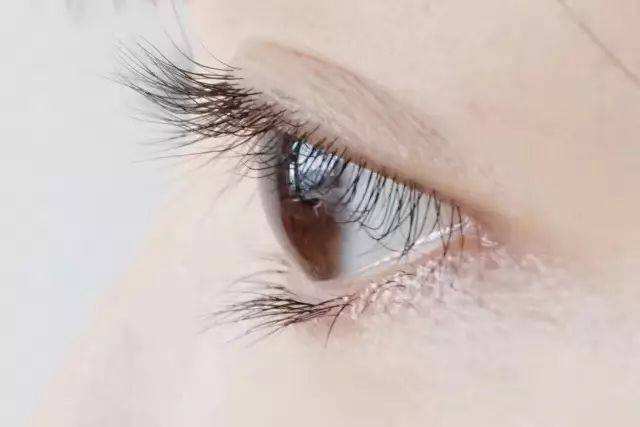 肿泡眼可以做双眼皮手术吗