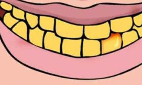 牙齿变黄：你知道为什么会逐渐变黄吗?