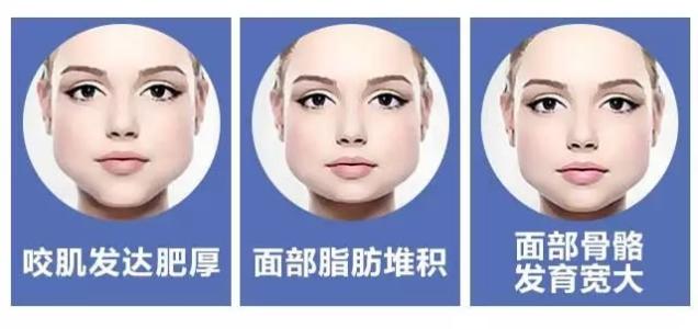 美莱哒注射瘦脸or面部吸脂，哪种更适合你？