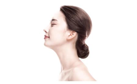 上海美莱做鼻尖整形可以改善的好蒜头鼻吗？