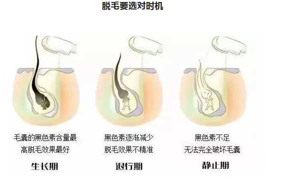 90％的人都错了？脱毛不错时节竟不夏天…