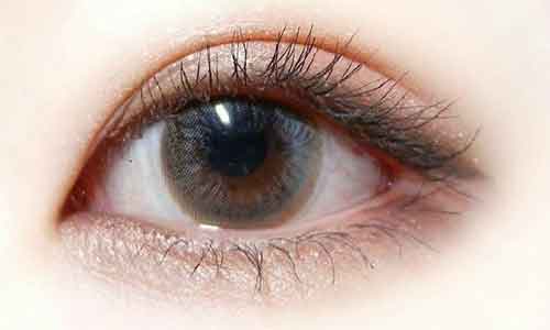 美莱医生告诉你:一般做双眼皮需要注意什么?