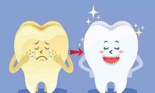 遗传性黄牙如何治疗,怎么“变白”?