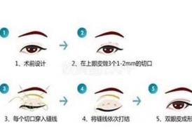 上海割双眼皮眼睛会变大吗,做双眼皮还有哪些“优势”?