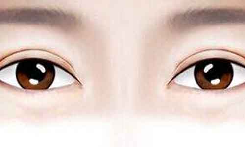 上海割双眼皮眼睛会变大吗,做双眼皮还有哪些“优势”?